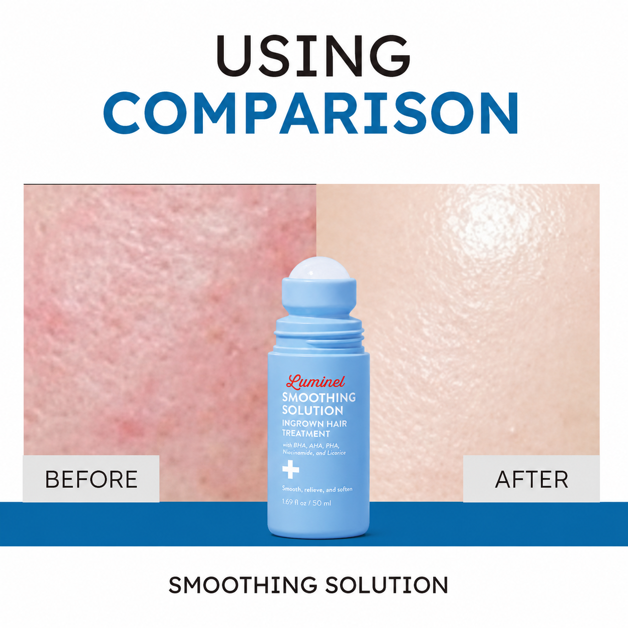Smoothing Solution Ingrown Hair Treatment
