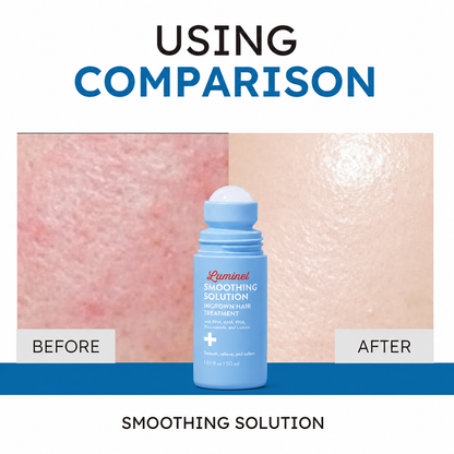 Smoothing Solution Ingrown Hair Treatment