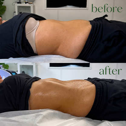 Lymphatic Drainage Drops