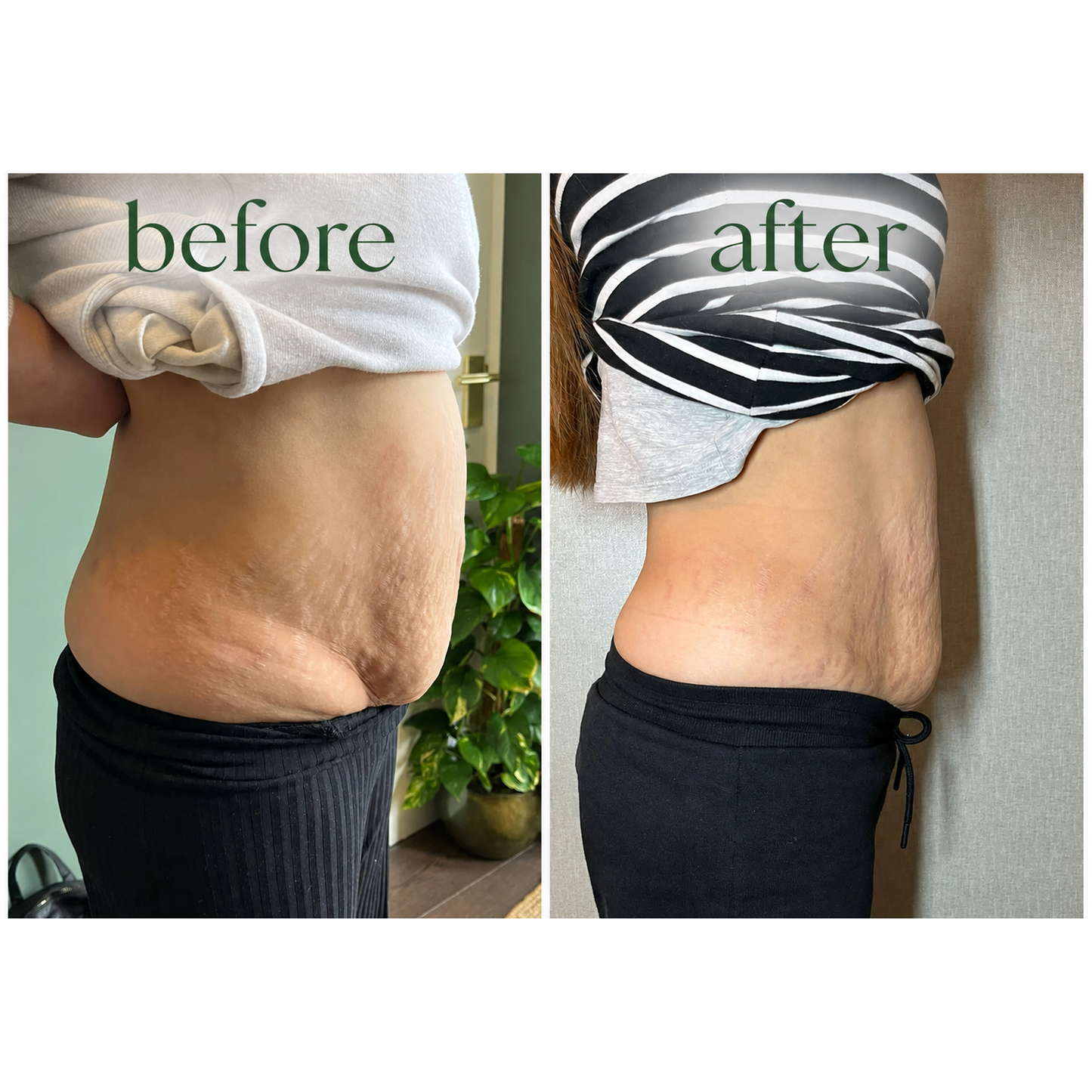 Lymphatic Drainage Drops